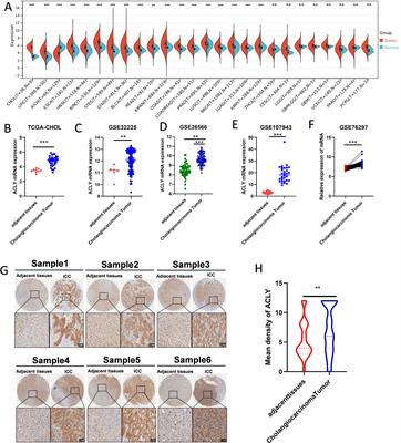 The pathological significance and potential mechanism of ACLY in cholangiocarcinoma